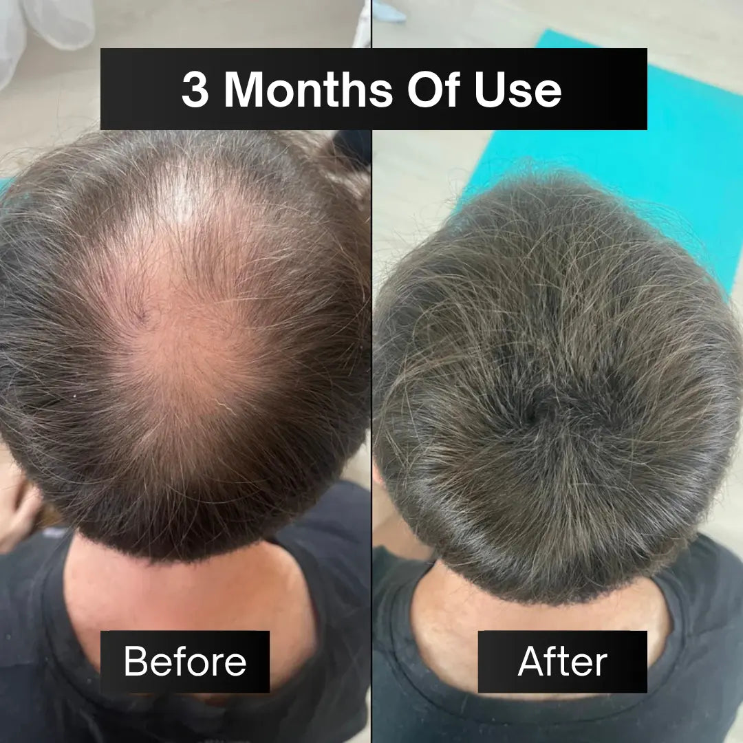 Anti Hair Loss & Hair Growth Serum